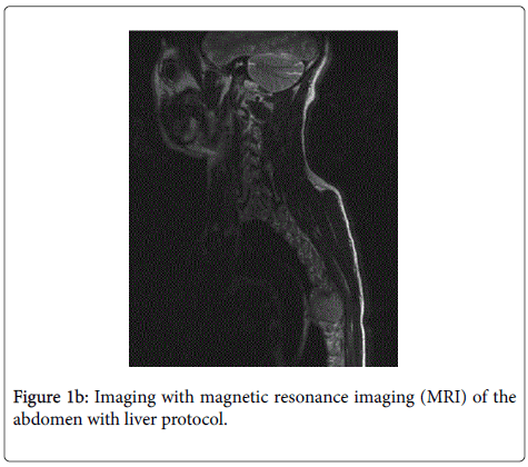 gastrointestinal-digestive-magnetic-resonance