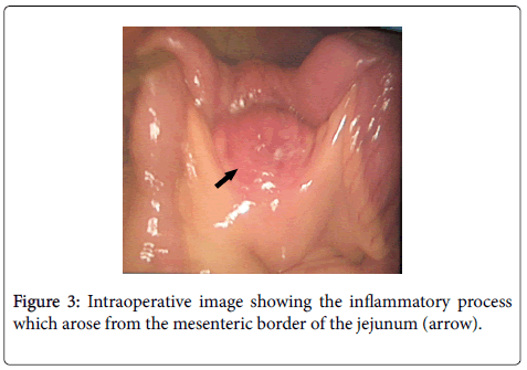 gastrointestinal-digestive-mesenteric-border-jejunum