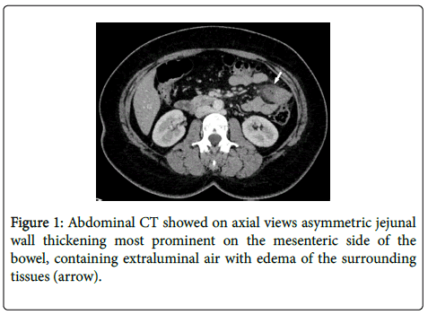 gastrointestinal-digestive-mesenteric-side