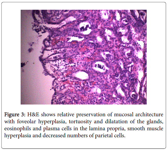 gastrointestinal-digestive-mucosal-architecture