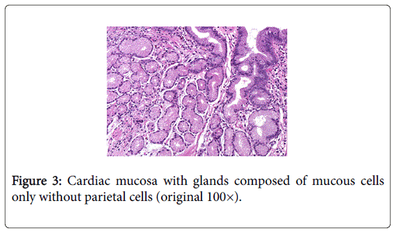 gastrointestinal-digestive-mucous-cells