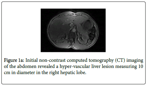 gastrointestinal-digestive-non-contrast