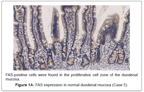 gastrointestinal-digestive-normal-duodenal-mucosa