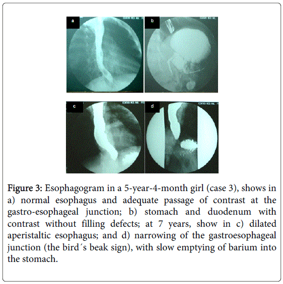 gastrointestinal-digestive-normal-esophagus-adequate