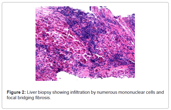 gastrointestinal-digestive-numerous-mononuclear-cells