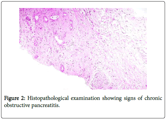 gastrointestinal-digestive-obstructive-pancreatitis