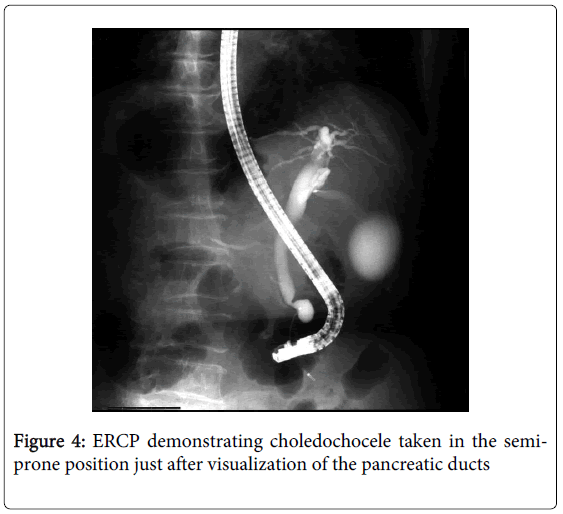 gastrointestinal-digestive-pancreatic-ducts