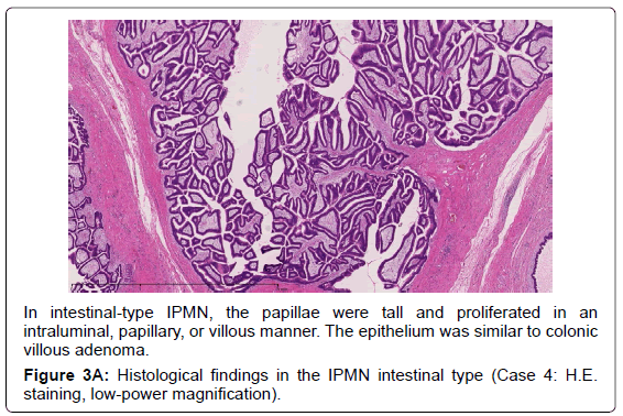 gastrointestinal-digestive-papillary-villous-manner