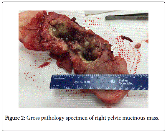 gastrointestinal-digestive-pathology-specimen-right