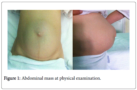 gastrointestinal-digestive-physical-examination