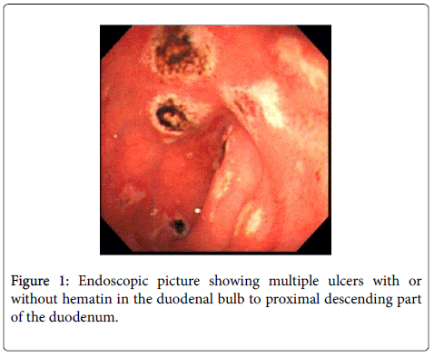 gastrointestinal-digestive-proximal-descending