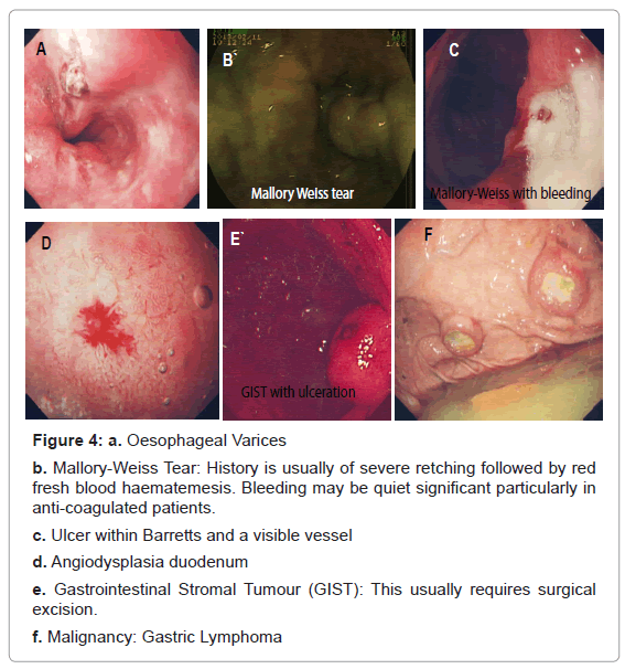 gastrointestinal-digestive-quiet-significant-particularly