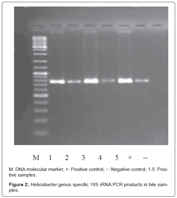 gastrointestinal-digestive-rRNA-PCR-products-bile