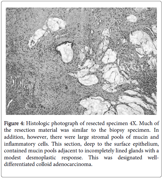 gastrointestinal-digestive-resected-specimen
