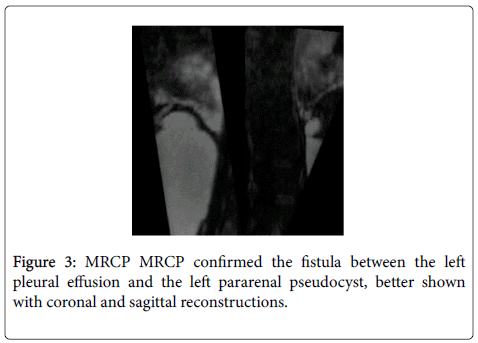 gastrointestinal-digestive-sagittal-reconstructions