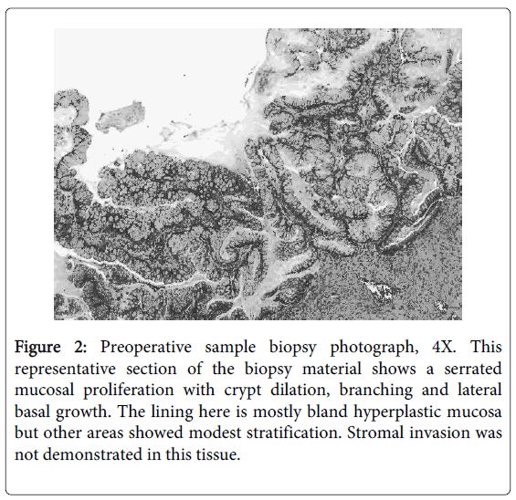 gastrointestinal-digestive-sample-biopsy-photograph