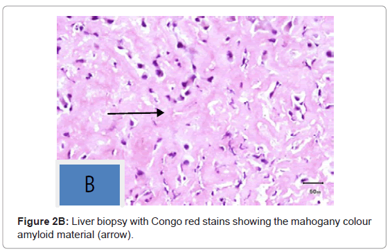 gastrointestinal-digestive-showing-mahogany-colour
