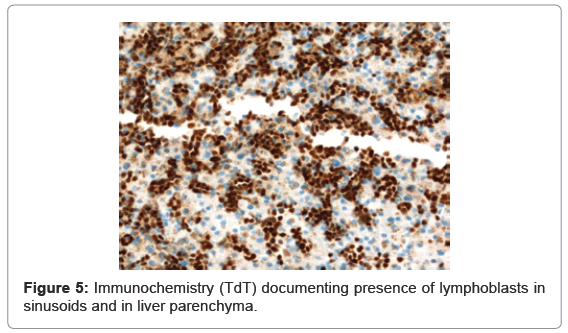 gastrointestinal-digestive-sinusoids-liver-parenchyma