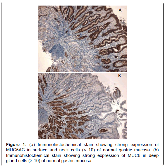 gastrointestinal-digestive-stain-showing-strong-expression
