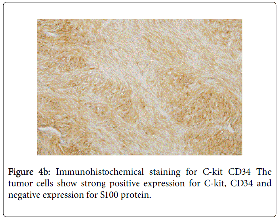 gastrointestinal-digestive-staining-C-kit-CD34