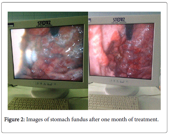 gastrointestinal-digestive-stomach-fundus