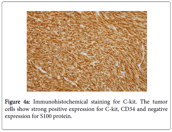gastrointestinal-digestive-strong-positive-expression