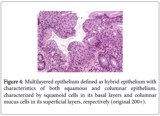 gastrointestinal-digestive-superficial-layers-respectively