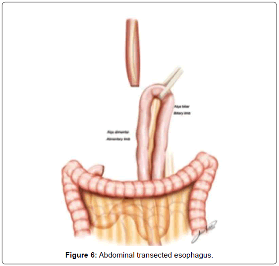gastrointestinal-digestive-system-Abdominal-transected