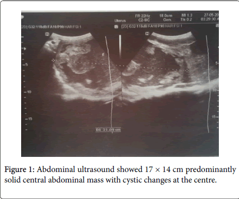 gastrointestinal-digestive-system-Abdominal-ultrasound