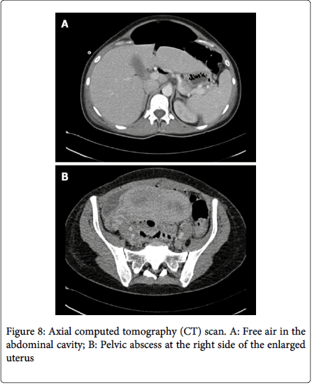 gastrointestinal-digestive-system-Axial-computed