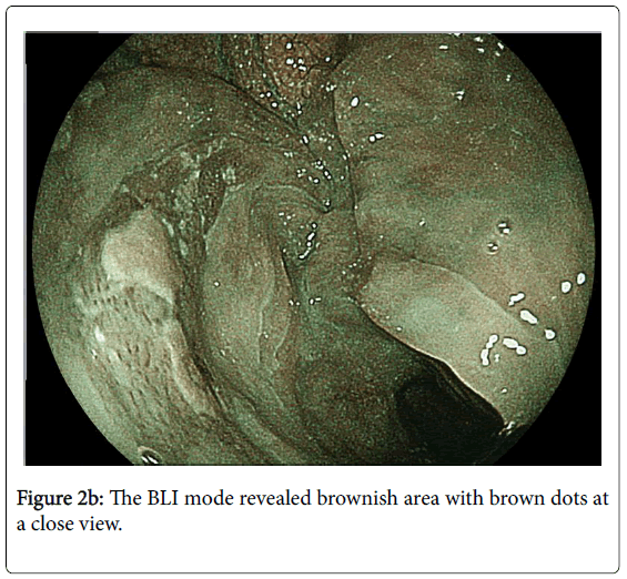 gastrointestinal-digestive-system-BLI-mode