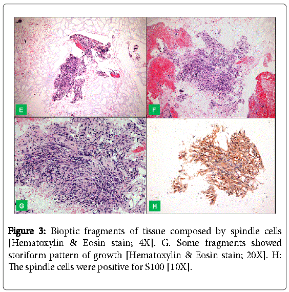 gastrointestinal-digestive-system-Bioptic-fragments