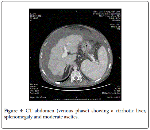 gastrointestinal-digestive-system-CT-abdomen