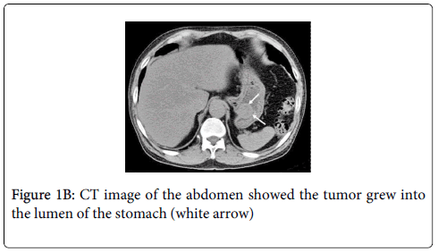gastrointestinal-digestive-system-CT-image