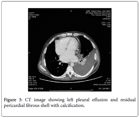 gastrointestinal-digestive-system-CT-image