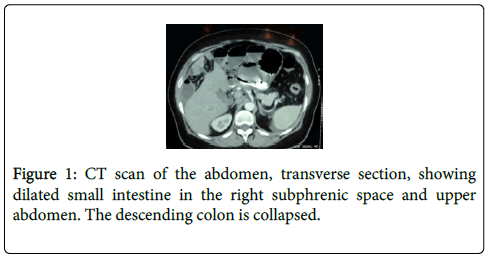 gastrointestinal-digestive-system-CT-scan