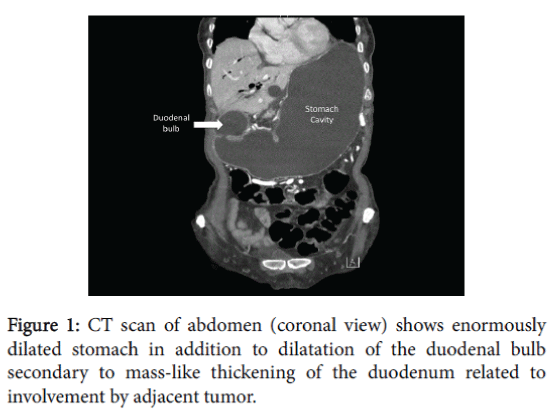 gastrointestinal-digestive-system-CT-scan