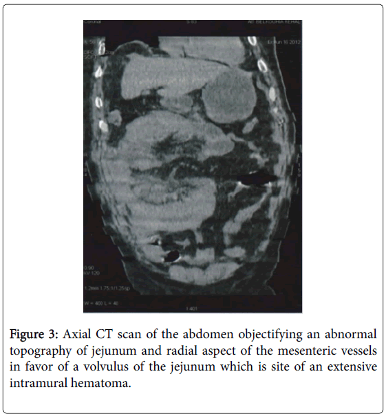 gastrointestinal-digestive-system-CT-scan