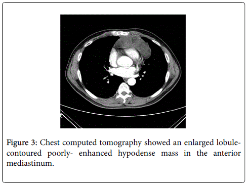 gastrointestinal-digestive-system-Chest-computed