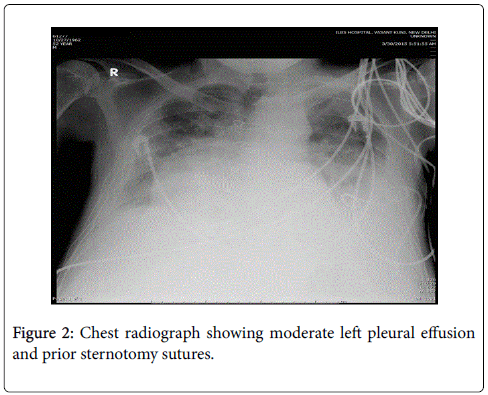 gastrointestinal-digestive-system-Chest-radiograph