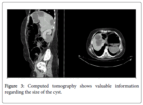 gastrointestinal-digestive-system-Computed-tomography