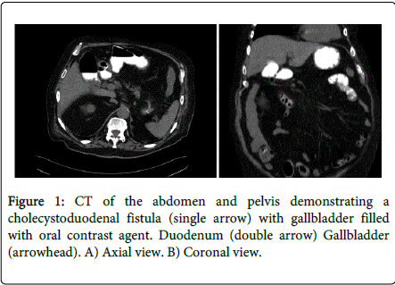 gastrointestinal-digestive-system-Coronal-view