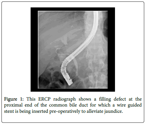 gastrointestinal-digestive-system-ERCP-radiograph