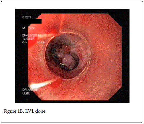 gastrointestinal-digestive-system-EVL-done