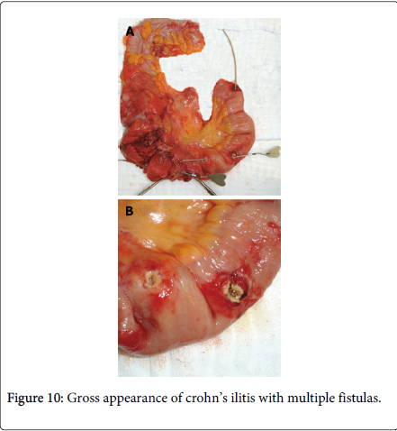 gastrointestinal-digestive-system-Endometrial-glands