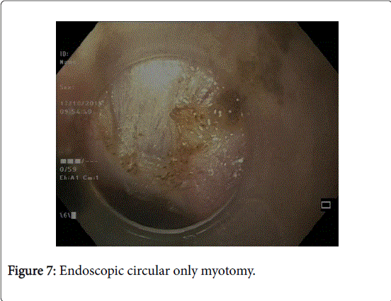 gastrointestinal-digestive-system-Endoscopic-circular