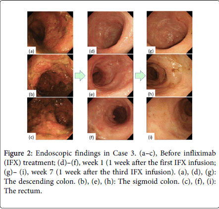 gastrointestinal-digestive-system-Endoscopic-findings
