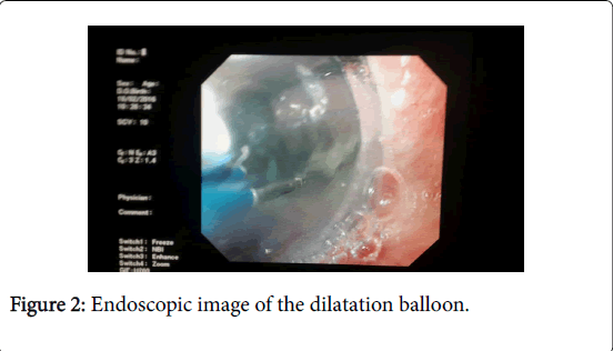 gastrointestinal-digestive-system-Endoscopic-image