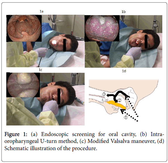 gastrointestinal-digestive-system-Endoscopic-screening