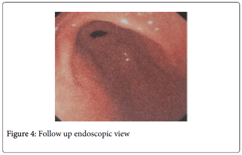 gastrointestinal-digestive-system-Follow-up